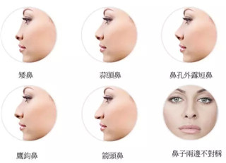 打玻尿酸鼻子會(huì)變寬，是不是真的？