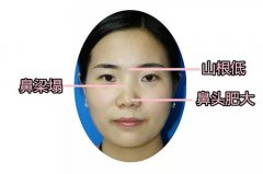 蘇州做韓式隆鼻手術(shù)要多少錢(qián)