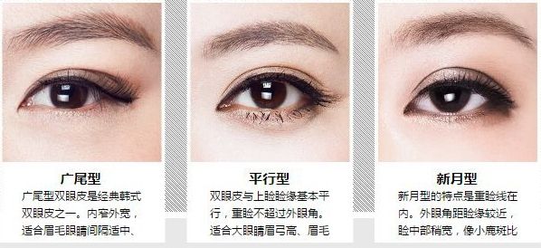 寧波做雙眼皮手術(shù)后眼睛腫脹怎么辦？