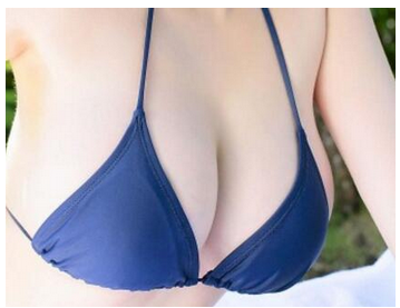 杭州做自體脂肪隆胸術(shù)創(chuàng)傷大嗎？