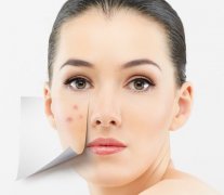 臉上長(zhǎng)痘怎么辦？