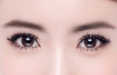 北京做雙眼皮術(shù)后恢復(fù)期要禁止哪些呢？