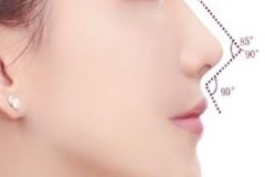成都做硅膠假體隆鼻多少錢(qián)