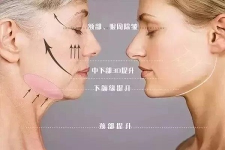 長了痘為啥消不下去！？