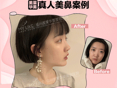 現(xiàn)在卻擁有魔鬼身材，簡(jiǎn)直是“行走的美人魚”