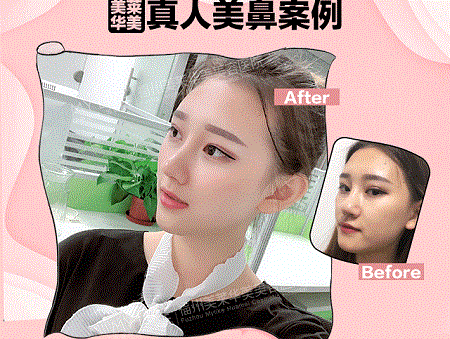 現(xiàn)在卻擁有魔鬼身材，簡(jiǎn)直是“行走的美人魚”
