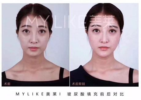 卻比喬妹還能收割男神？！