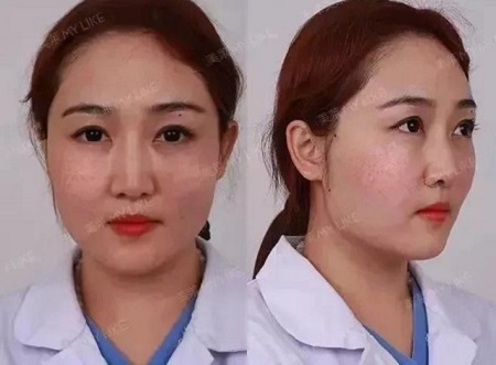 全日本女生較想整容的范本竟是她？！