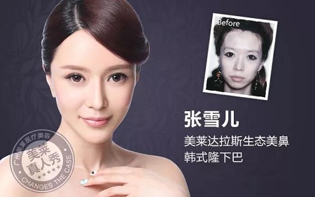  23-24日，韓國較會整容的柳元敏博士，來了！