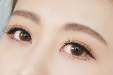 去眼袋的價格？