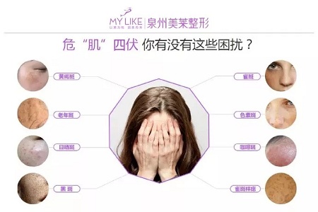 斑，是怎么出現(xiàn)的呢？！