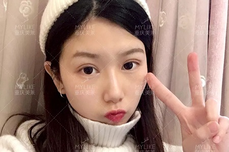 市面上五花八門(mén)的雙眼皮項(xiàng)目，如何有效找到你的菜？