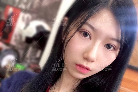 市面上五花八門(mén)的雙眼皮項(xiàng)目，如何有效找到你的菜？