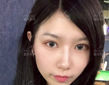 市面上五花八門(mén)的雙眼皮項(xiàng)目，如何有效找到你的菜？
