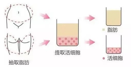 美萊實驗室：當(dāng)顏值遇上“胸”霸，男人一般都會怎么選？