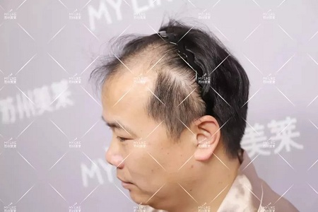 好看的皮囊千千萬，但都有一個(gè)共同點(diǎn)-頭發(fā)！