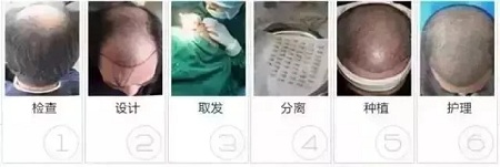 好看的皮囊千千萬，但都有一個(gè)共同點(diǎn)-頭發(fā)！