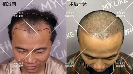 好看的皮囊千千萬，但都有一個(gè)共同點(diǎn)-頭發(fā)！