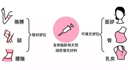 腿再瘦一點(diǎn)？腰再細(xì)一點(diǎn)？胸再大一點(diǎn)？自體脂肪填充，一步到位！