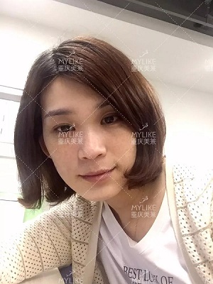那個斑點女孩后來怎么樣了？