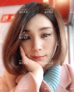 那個斑點女孩后來怎么樣了？