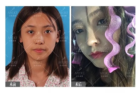 顏值：鼻子一小步，顏值一大步~