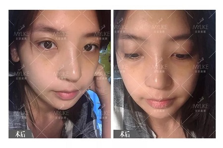 顏值：鼻子一小步，顏值一大步~