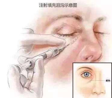 顯老淚溝，你還要任其放肆嗎？