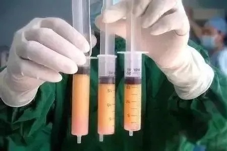顯老淚溝，你還要任其放肆嗎？