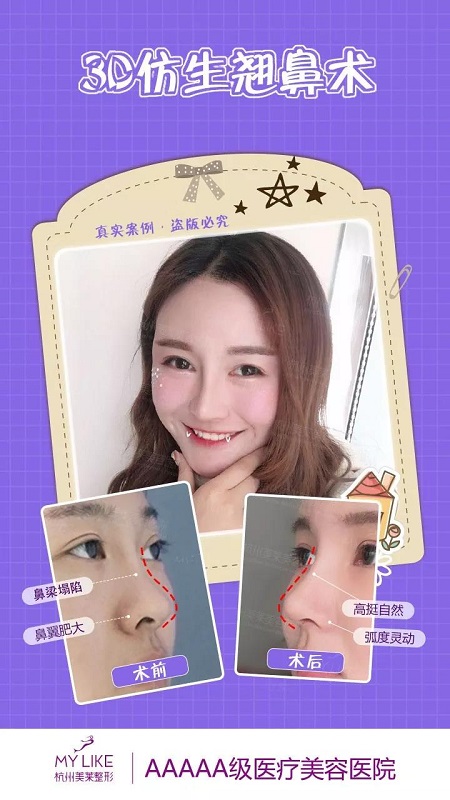 CURE全度美眸，仿生3D翹鼻，想美哪里你來定