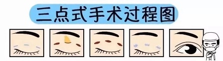 美眼張誠(chéng)坐診美萊，淺談為什么你的眼睛不夠美？