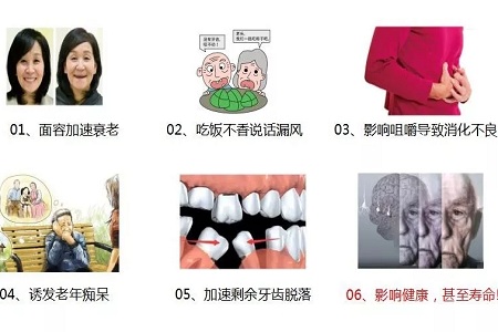 牙齒缺失時，選烤瓷牙還是那種？