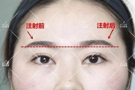 想要?dú)W式大眼，一定要注意與這個(gè)部位協(xié)調(diào)！