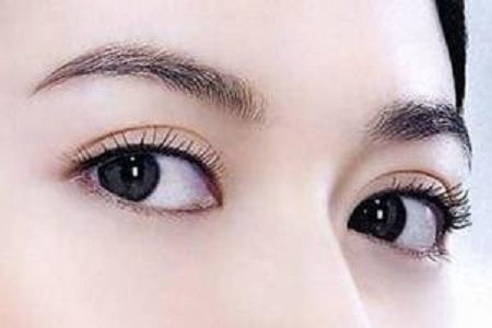開眼角手術(shù)費(fèi)用多少 媚眼勾魂！