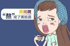 激光真的能去黃褐斑嗎，祛斑價格是多少